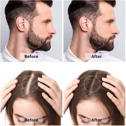 Ramya beauty care Rus Derma Roller for Hair Growth and Beard Growth, 0.5mm 540 Micro Needles