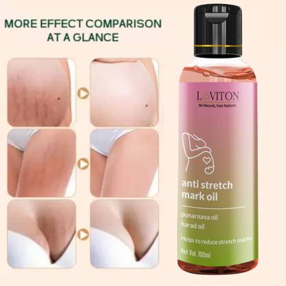 loviton Stretch Mark Oil for Remove Hyperpigmentation, anti-Cellulite, remover scars