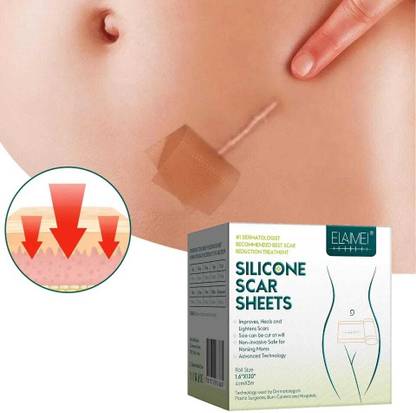 Dr. NAvadiya Silicone Scar Removal Sheets - Keloid, Surgery Scar & C Section