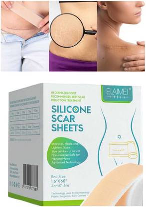 Dr. NAvadiya Soft Silicone Scar Tape for Scars Removal,, Scars Removal