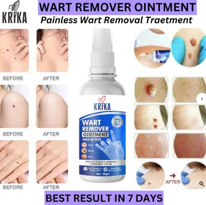 krika WART OINTMENT TREATMENT