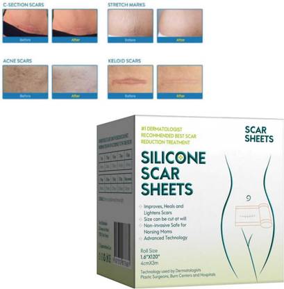 Dr. NAvadiya Easy & Reusable Soft Silicone Scar Sheet, Surgery, C-section, Burn