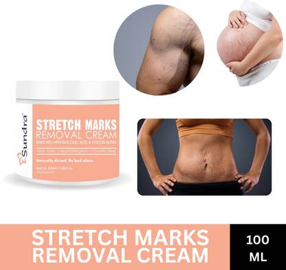 sundra Stretch Marks Removal Cream Enriched With Glycolic Acid & Cocoa Butter