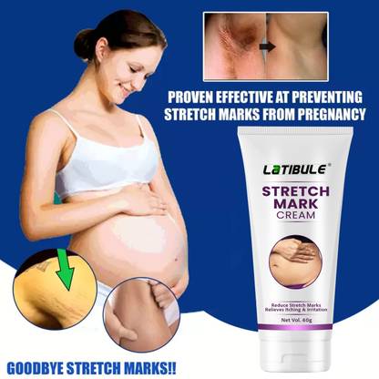 Latibule Stretch Cream For Stretch Marks Removal Post Pregnancy Fast work