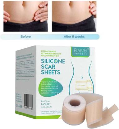 Green Aroma Silicone Scar Sheet, Gel Transperant Medical Silicone Sheet, C-Section, Surgery Crepe Bandage