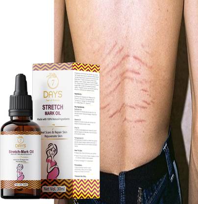 7 Days stretch marks oil cream after delivery stretch marks cream before delivery