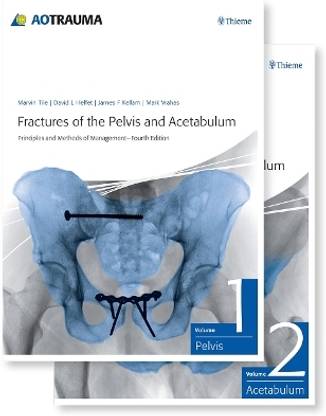 Fractures of the Pelvis and Acetabulum (AO)