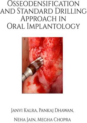 Osseodensification and Standard Drilling Approach in Oral Implantology