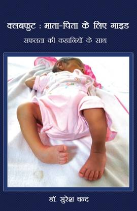 Clubfoot: Guide for parents (with success stories) by Dr Suresh Chand