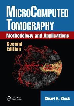 MicroComputed Tomography