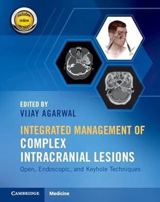 Integrated Management of Complex Intracranial Lesions