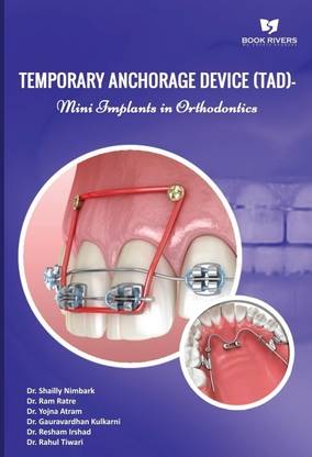 TEMPORARY ANCHORAGE DEVICE (TAD) - MINI IMPLANTS IN ORTHODONTICS