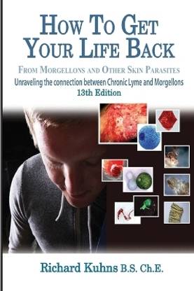 How to Get Your Life Back From Morgellons and Other Skin Parasites Limited Edit