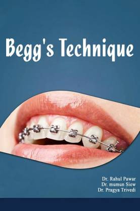 Begg's Technique