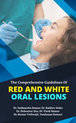 The Comprehensive Guidelines of Red and White Oral Lesions