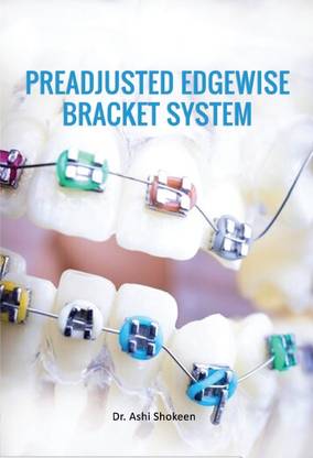 Preadjusted Edgewise Bracket System