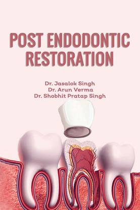 POST ENDODONTIC RESTORATION