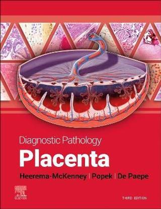 Diagnostic Pathology: Placenta