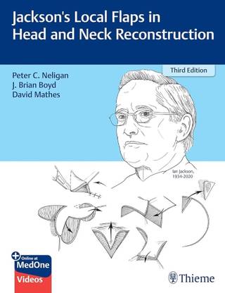Jackson's Local Flaps in Head and Neck Reconstruction