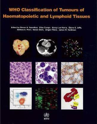 WHO classification of tumours of haematopoietic and lymphoid tissues