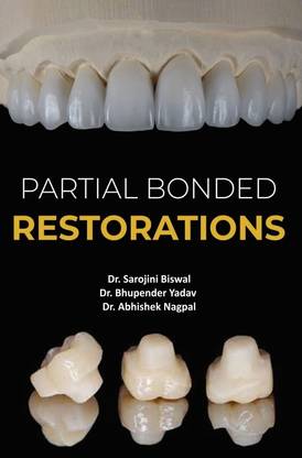 PARTIAL BONDED RESTORATIONS
