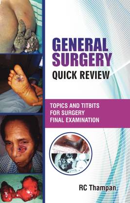GENERAL SURGERY QUICK REVIEW  - Topics and titbits for the surgery final examination