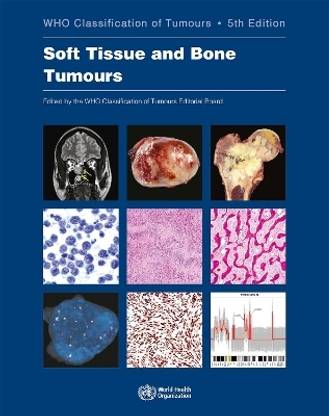 WHO classification of tumours of soft tissue and bone tumours