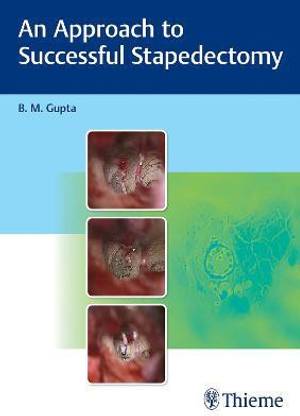 An Approach to Successful Stapedectomy