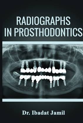 Radiographs In Prosthodontics