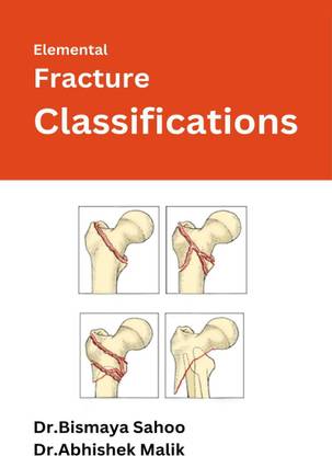 Elemental Fracture Classifications