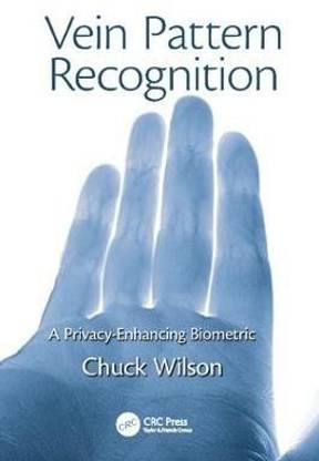 Vein Pattern Recognition