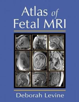 Atlas of Fetal MRI