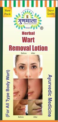 Gunmala Wart Removal Lotion ( 5 ml. ) pack of 5 Face Wash