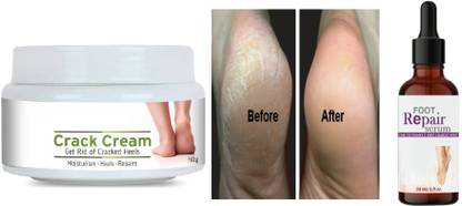 AFARAXIA foot serum Smooth Foot Crack Cracked Heel Repair Foot serum