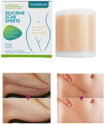 Green Aroma Medical Silicone Scar Tape Roll,Easy-Tear Soft Silicone Tape Scars Removal Crepe Bandage