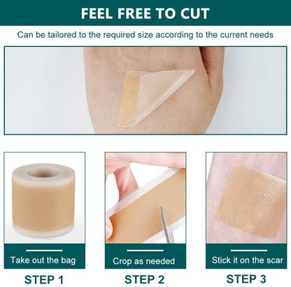 NIRMATSARAY 1 roll Silicone Scar Sheets, Silicon gel for Scars, Painless & Safe Scar Removal Crepe Bandage
