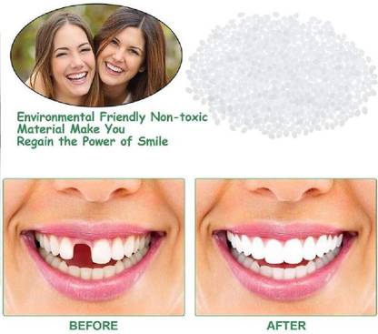 SRK 20ml Temporary Tooth Tooth Filling Temp Replace Missing Denture Teeth Repair Dental Implant