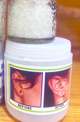 GreenStudio Reusable Ear Lobe Support