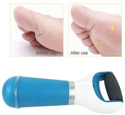 MYEONG Electronic Foot File
