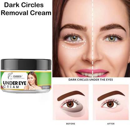 Ember Under Eye Cream, Dark Circle Remover Cream - Minimizes Darkened,