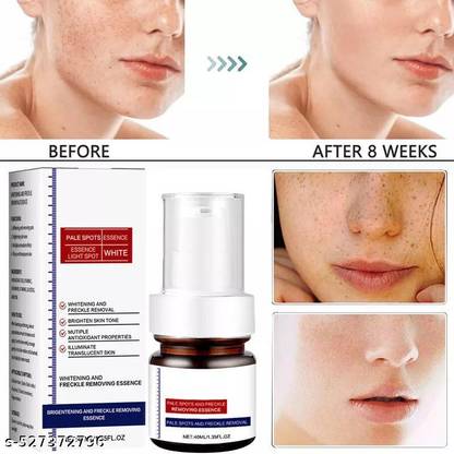 DRIDDLE ,Aobenz Spot Remover For Face, Aobenz Anti Spot Serum ( PACK OF 1 ) 007