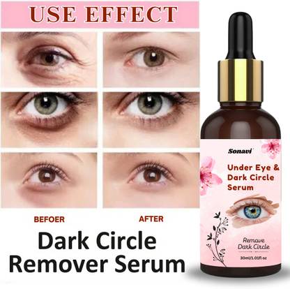 Sonavi Under Eye Serum For Fine Lines,Reduce Dark Circles & Puffiness, Eye Serum - 30ml