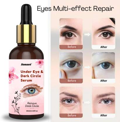 Sonavi Eye Serum For Men & Women Remove Dark Circles, Dark Circle Remover