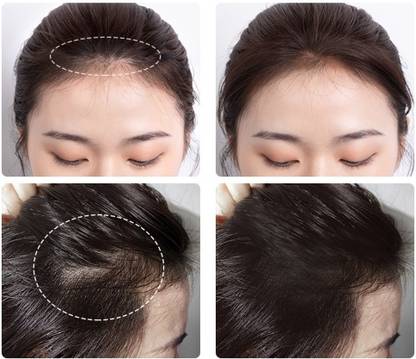 WOONGMI Quick Root Touch-Up Hairline For Man & Womens Hair Powder