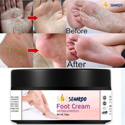 SENAROO Foot and Elbow Cream with Goodness of Turmeric and milk-50g