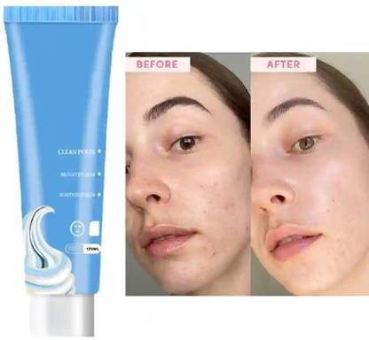 AFARAXIA USE CLEAN YOUR FACE AND REMOVE YOUR PIMPLES ICE CREAM MASK