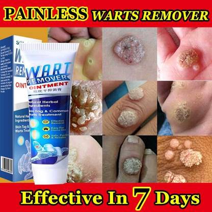 manasona Painless Warts Magic Ointment Original Wart Removal Cream