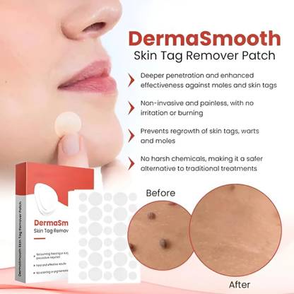 ERVY Derma Smooth Skin Tag Removal Patches - 36 Patches for All Skin Types