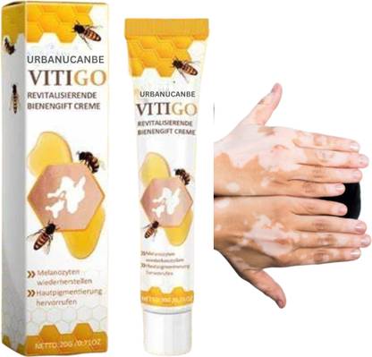 URBANUCANBE Vitiligo Bee Venom Treatment Cream pack of 1