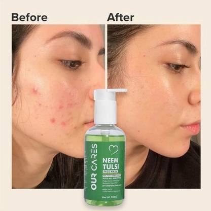 Ourcares Neem Tulsi  Gel: Clarify Your Complexion, Naturally Face Wash